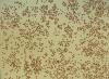 Ruscha, ED  Original Hand Signed and Numbered Screenprint 1972 Amercian Pop Art Insects