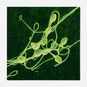 Untitled (Green Sperm)