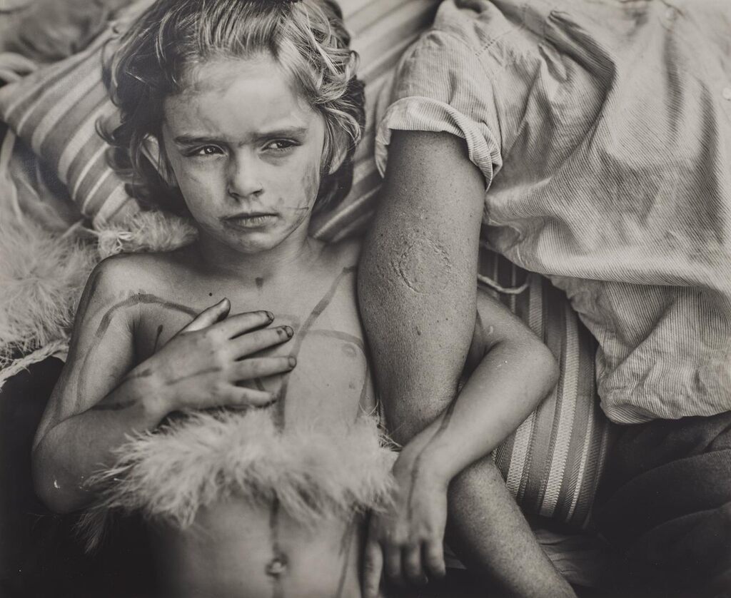 Jessie Bites, 1985