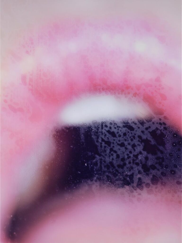 Fat Lip