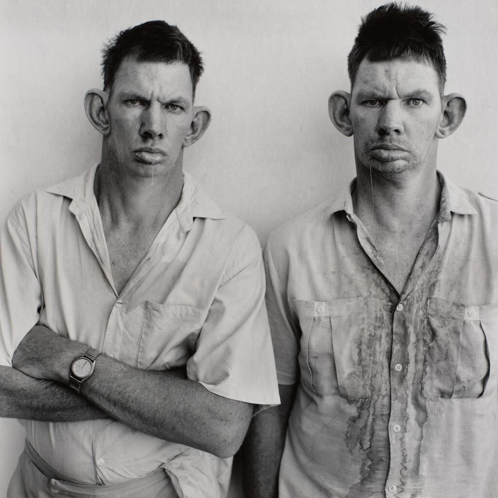 Dresie and Casie, Twins, Western Transvaal, South Africa