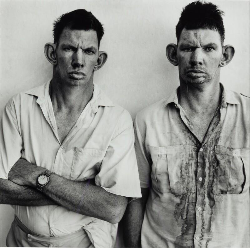 Dresie and Casie, Twins, Western Transvaal