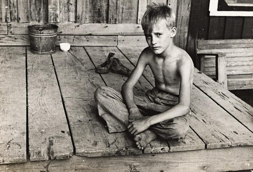 Son of a Sharecropper, Mississippi County, Arkansas; Sharecropper's child suffering from rickets and malnutrition, Wilson cotton plantation, Mississippi County, Arkansas