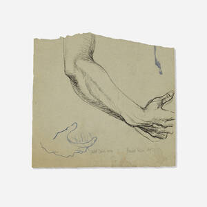 Robert Drew's Arm