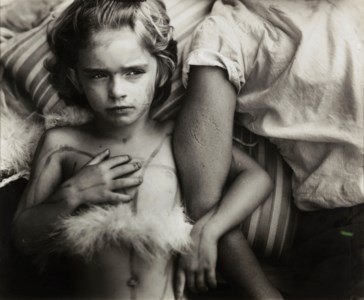 Jessie Bites, 1985