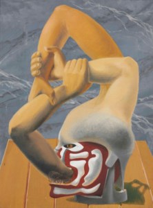 Artifact
