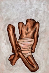 Wounds II