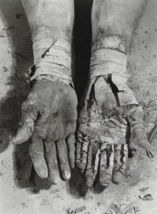 Die Befreiung der Finger, from Errinnerungsspur , 1977-1979