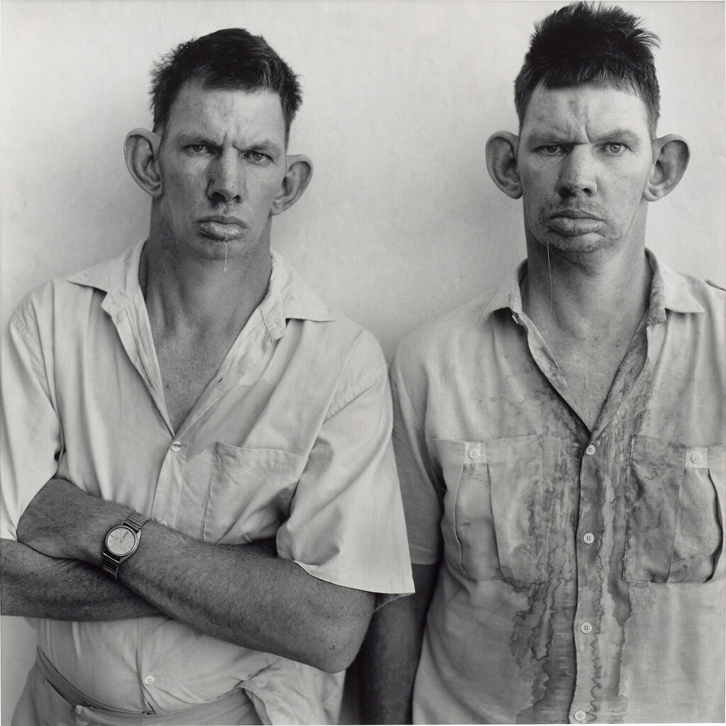Dresie and Casie, Twins, Western Transvaal