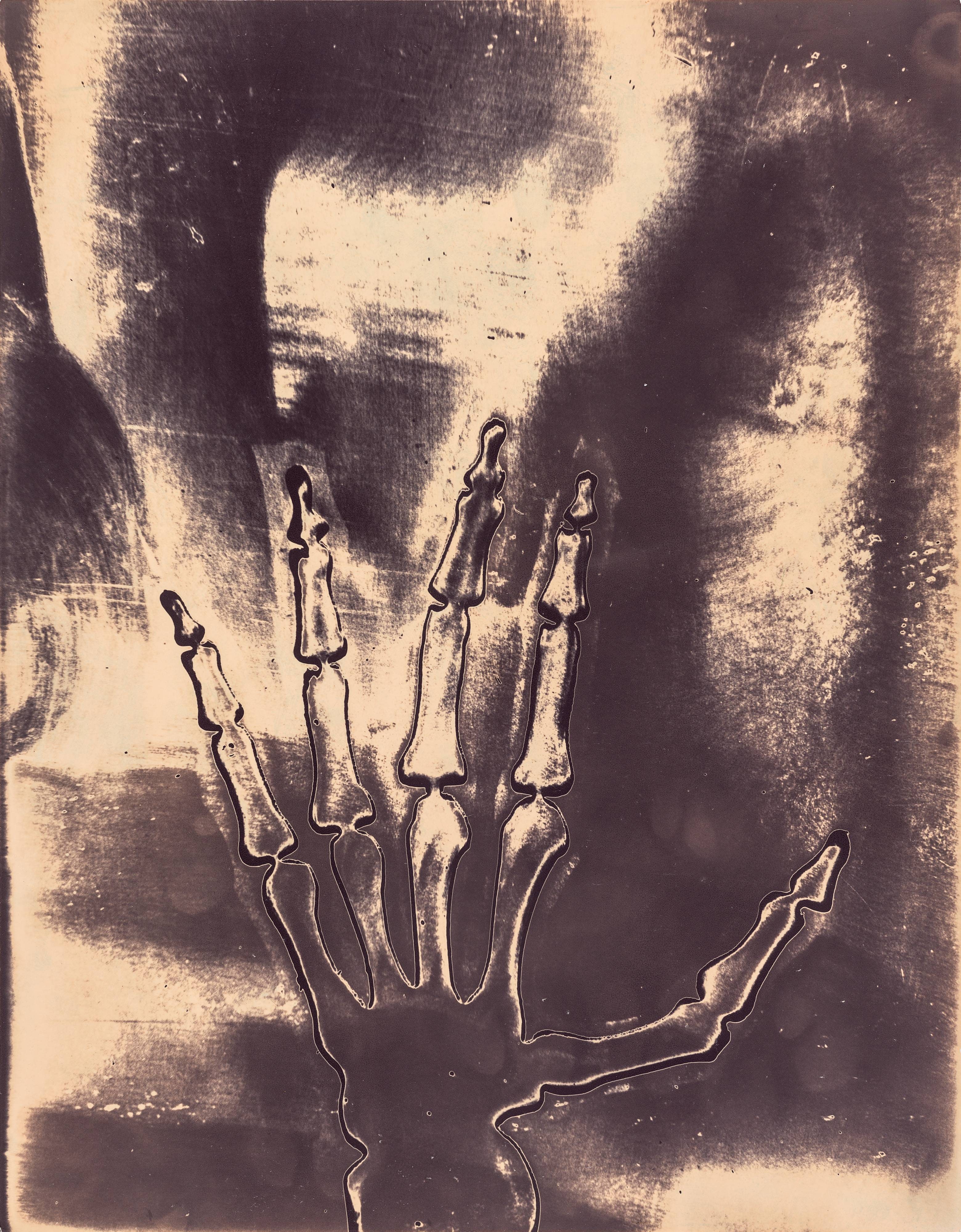 Skeleton