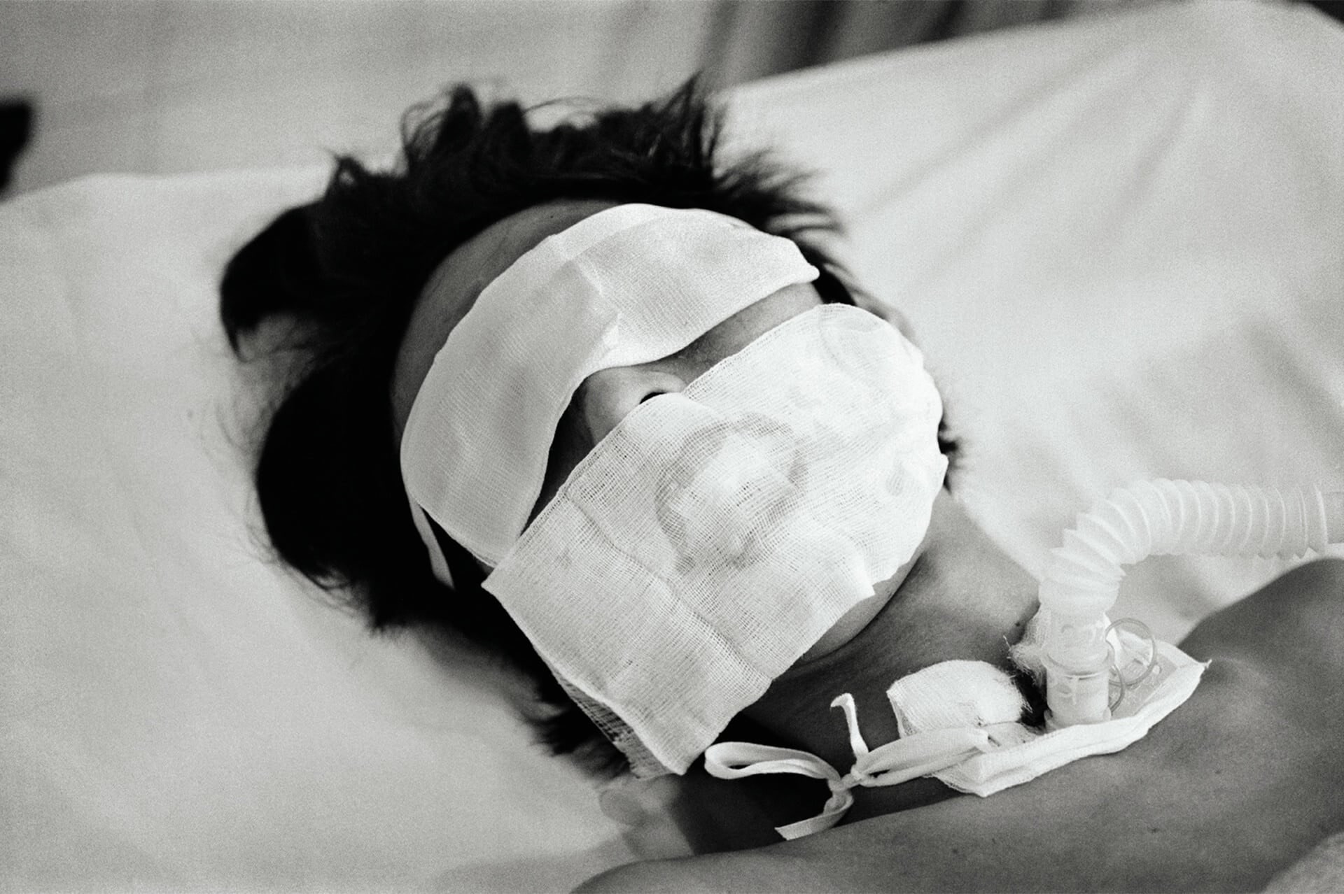 Bird Flu, Patient in Hanoi