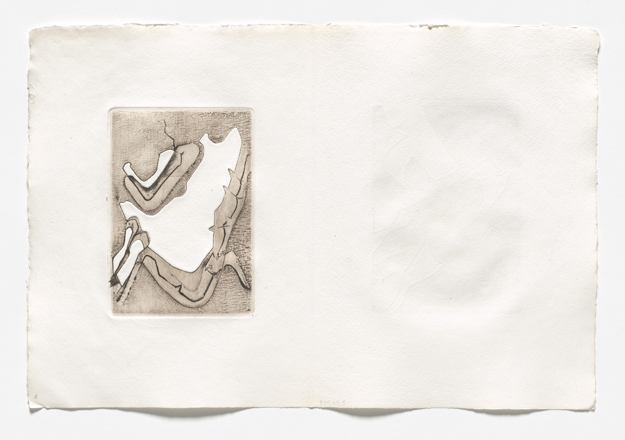 Plate (folio 13 verso) from Histoire des rechutes