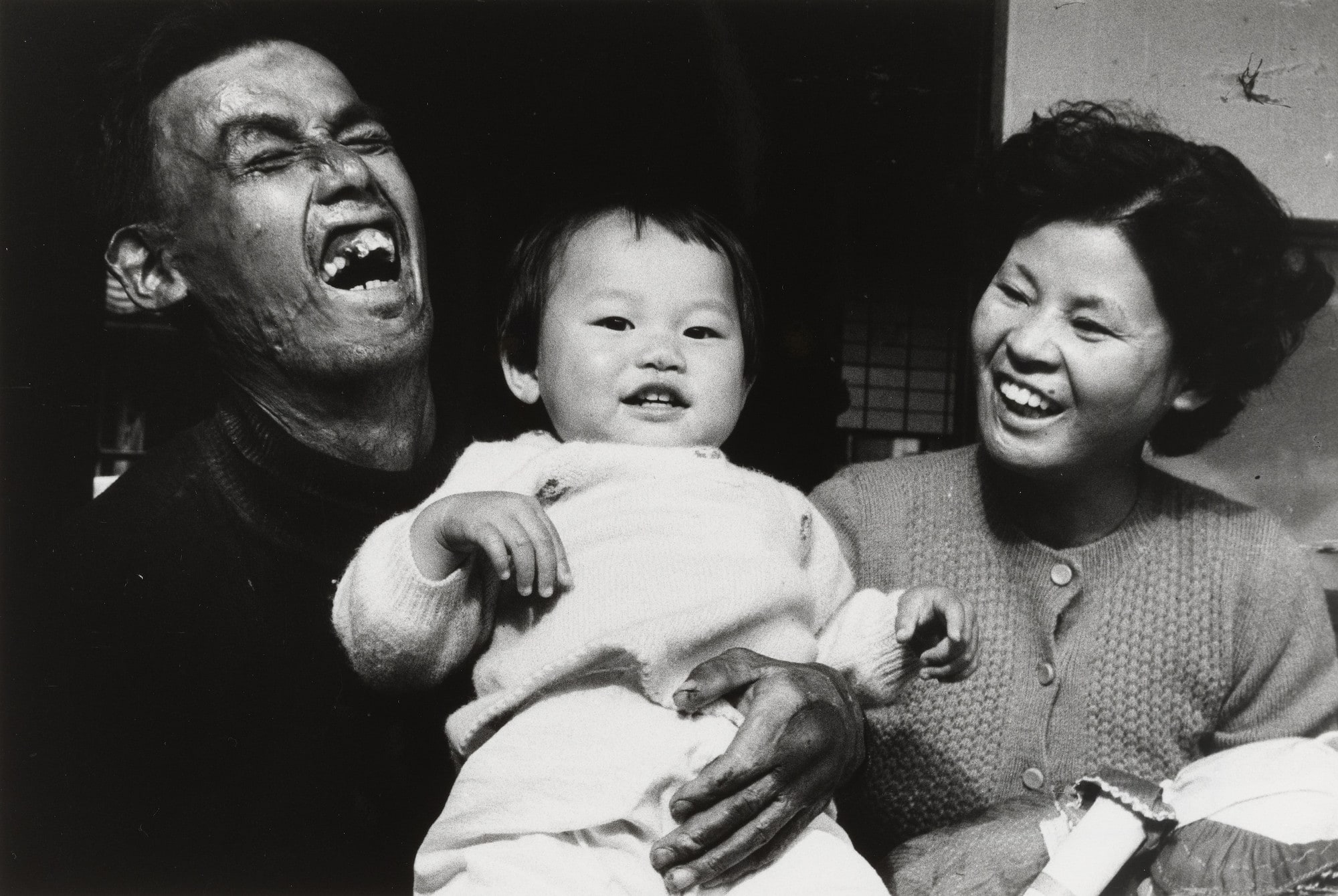 Mr. and Mrs. Kotani: Two Who Have Suffered from the Bomb