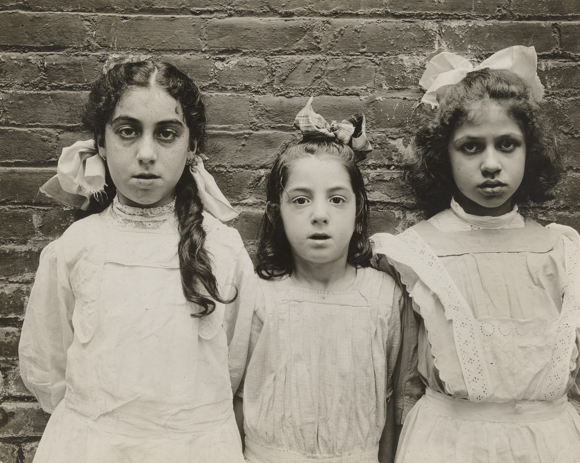 Physically Defective Children