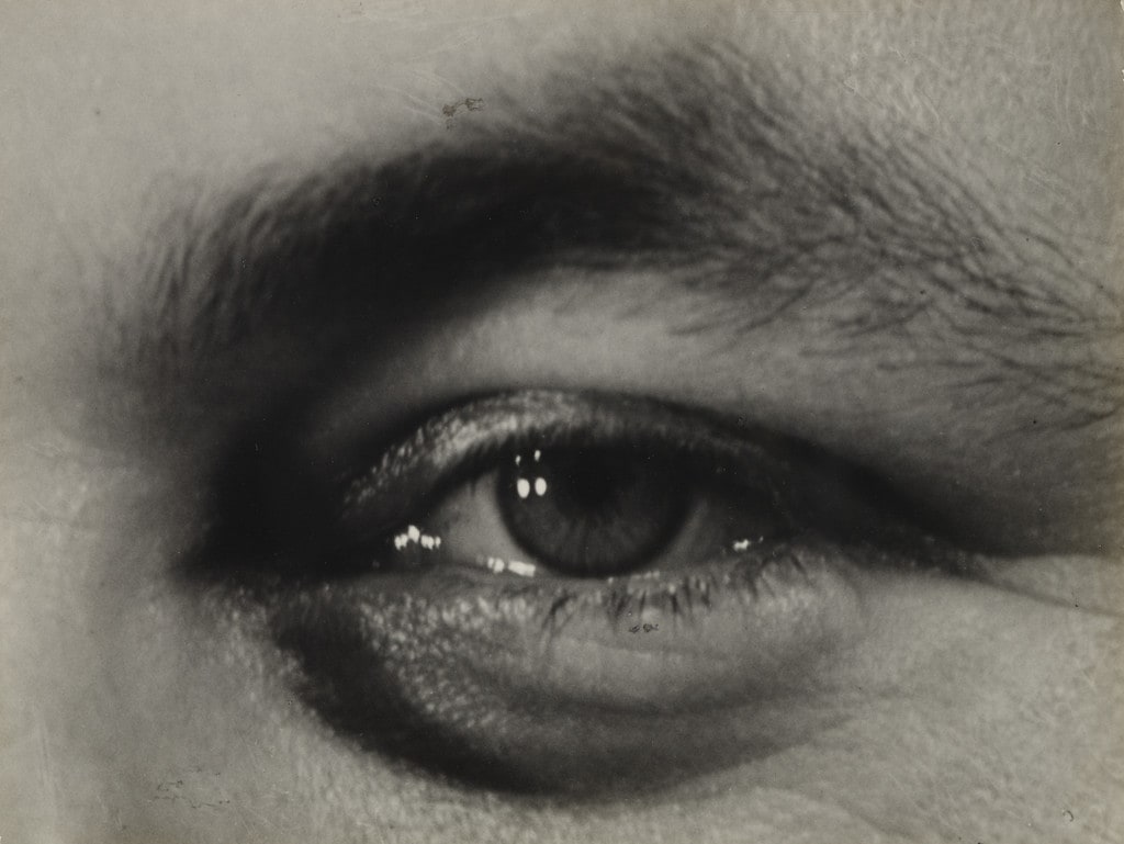 Right Eye