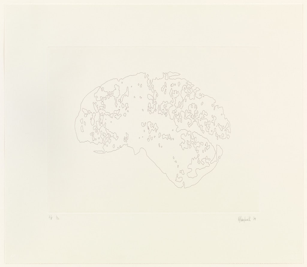 Mapping I (Brain)