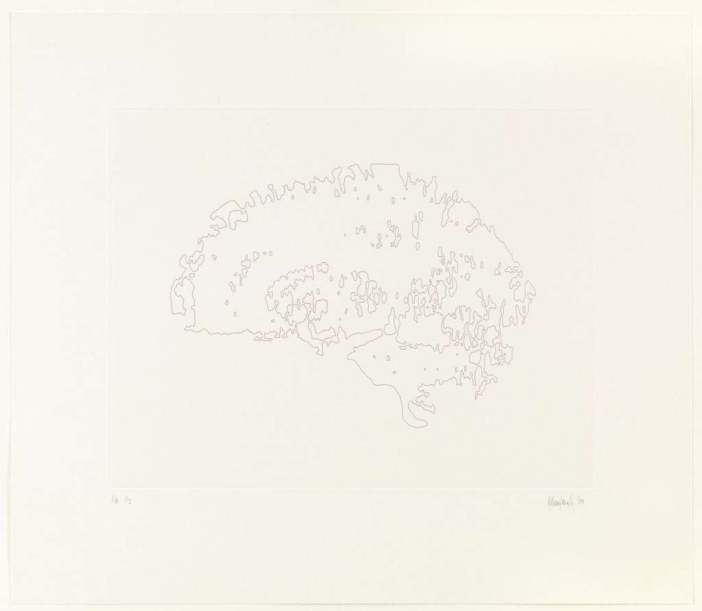 Mapping II (Brain)