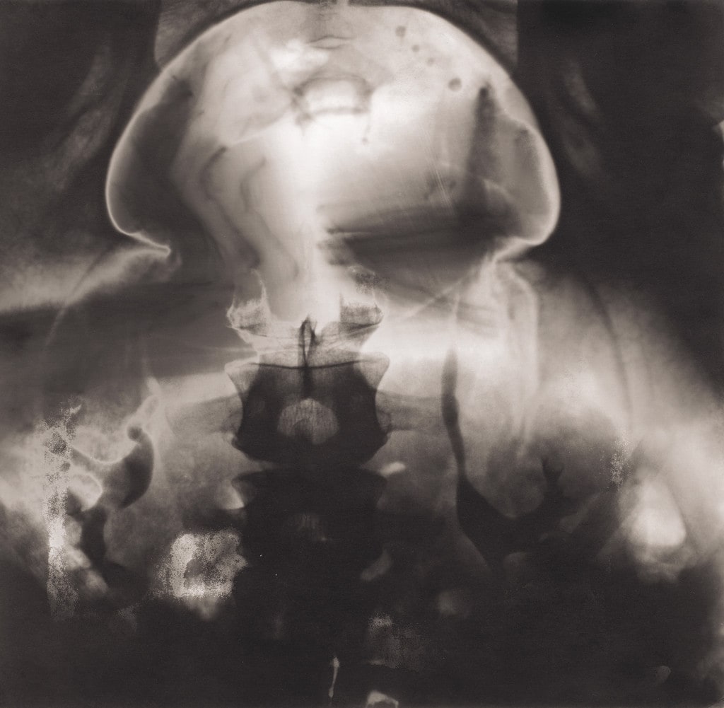 Mushroom Cloud