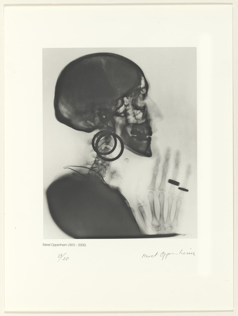 X-Ray of M.O.’s Skull (Röntgenaufnahme des Schädels M.O.)