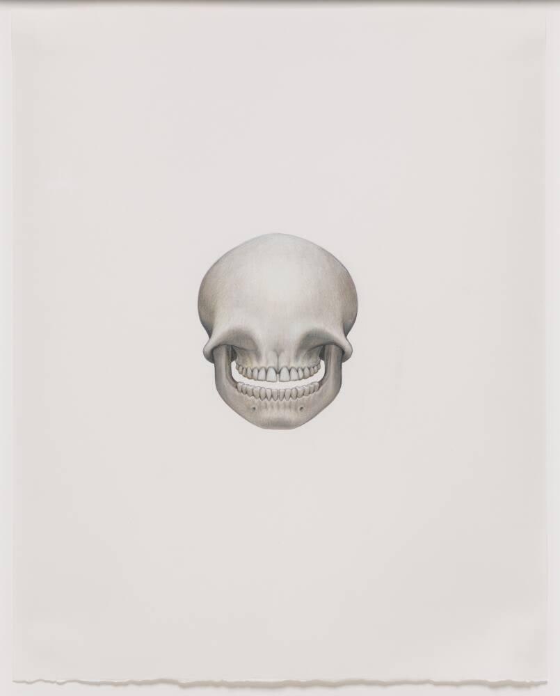 Compressed Skull