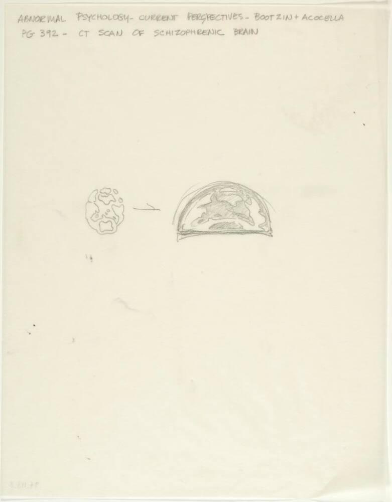 Drawing of Schizophrenic Brain Scan