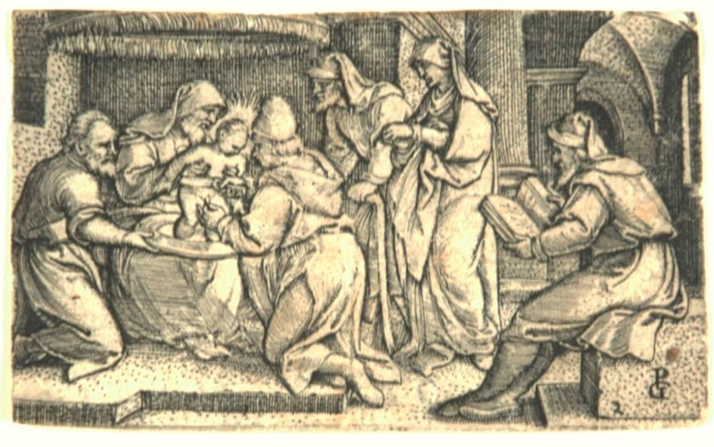 The Circumcision