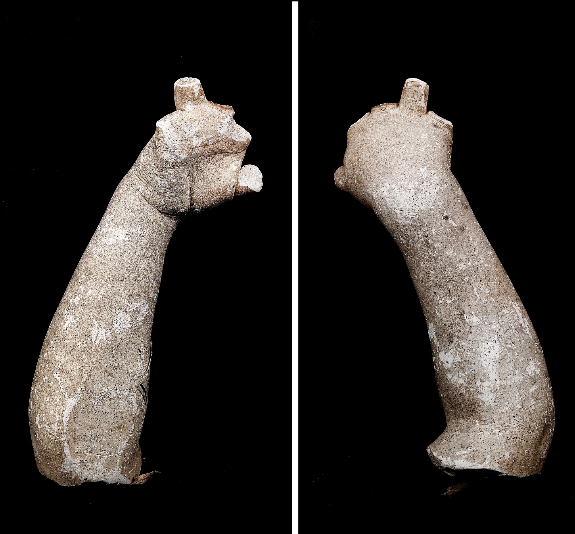 Cast of an Unidentified Baby's Right Hand and Forearm (all fingers missing)