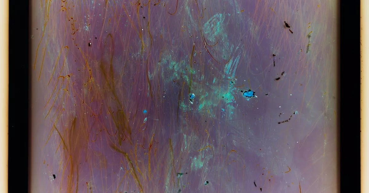 Infection