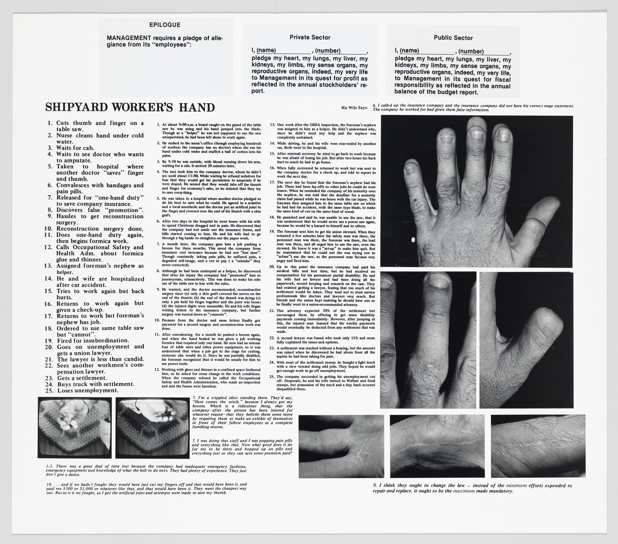 The Health and Safety Game: Shipyard Worker's Hand
