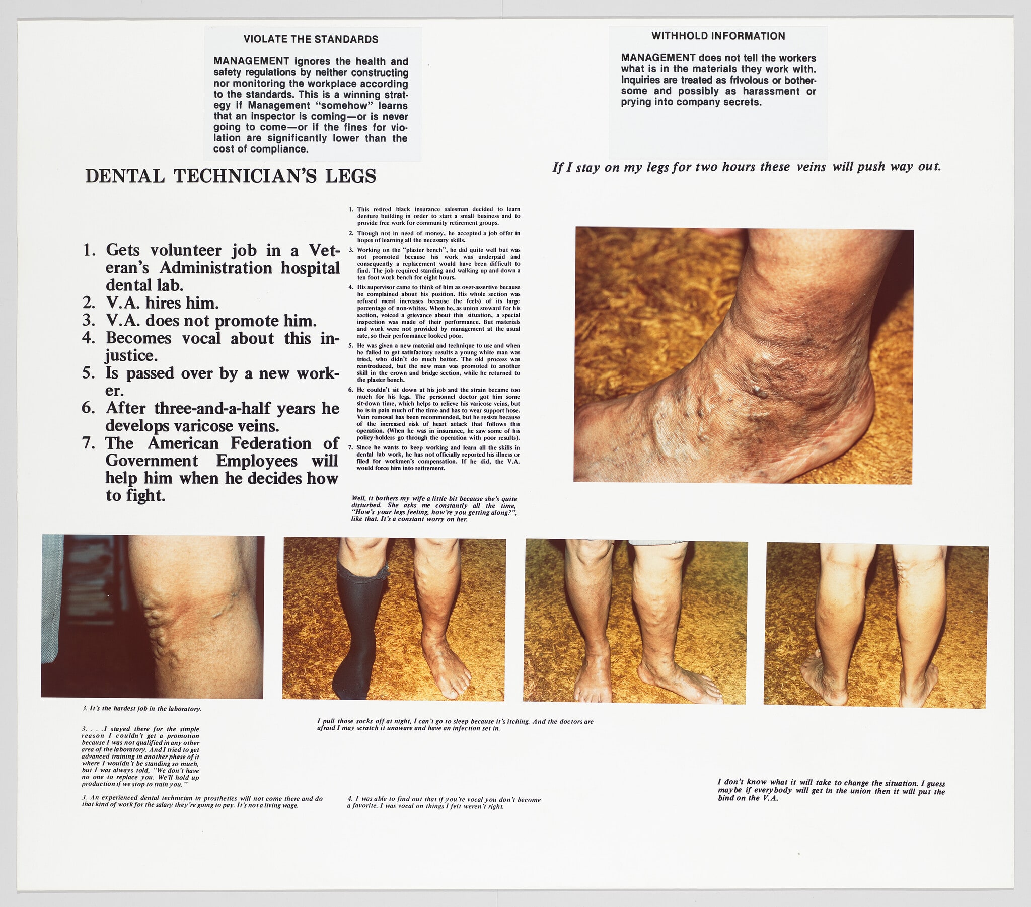 The Health and Safety Game: Dental Technician's Legs