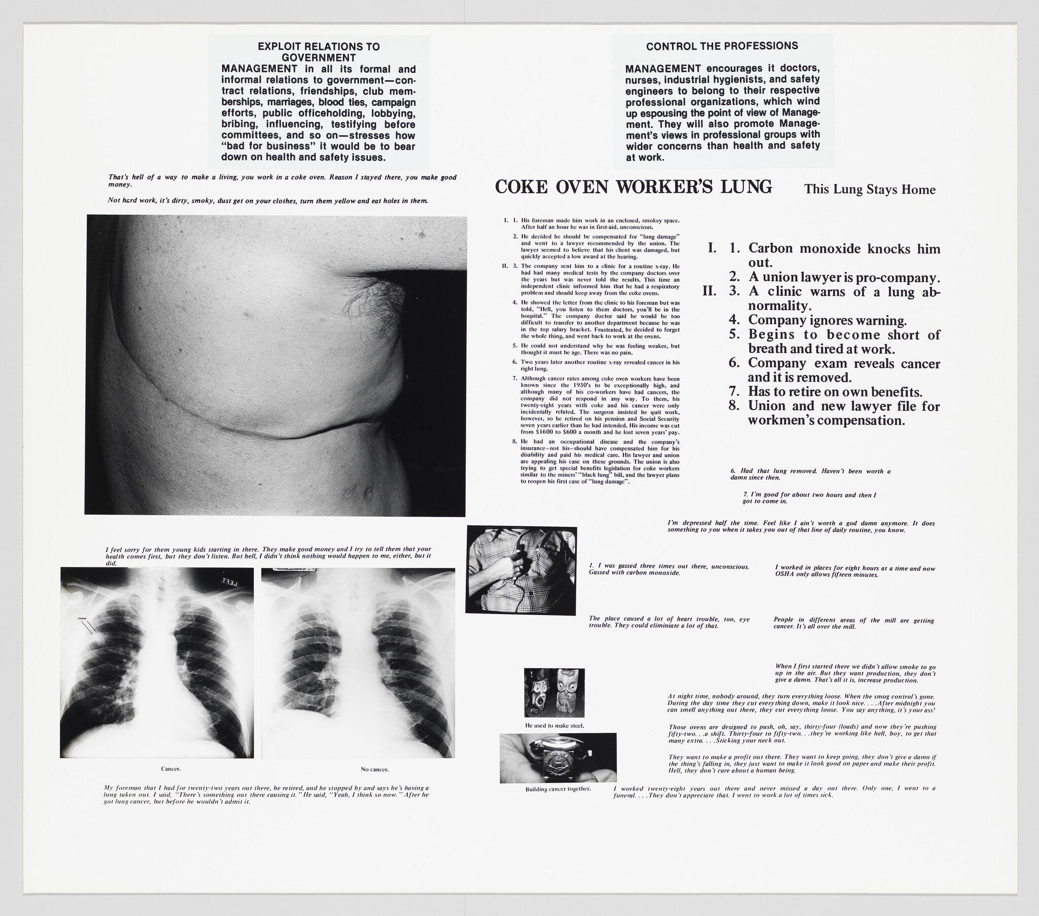 The Health and Safety Game: Coke Oven Worker's Lung, This Lung Stays Home