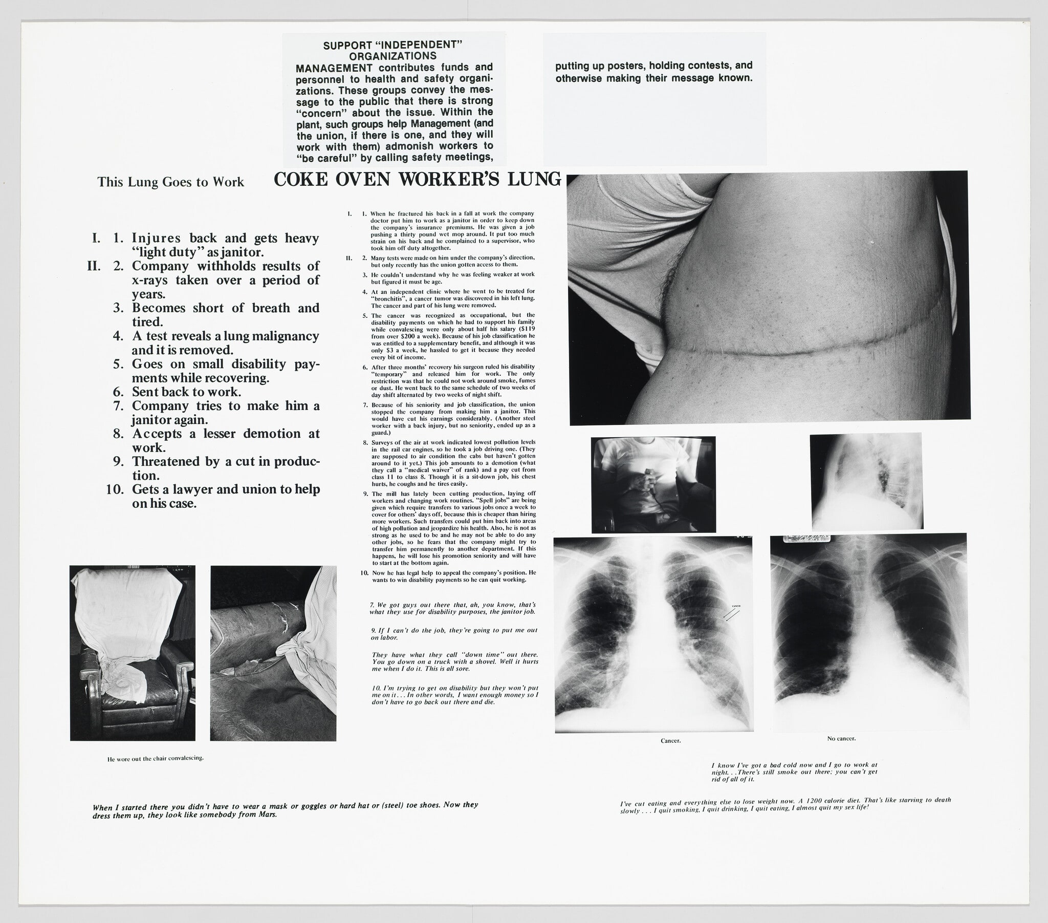The Health and Safety Game: Coke Oven Worker's Lung, This Lung Goes to Work