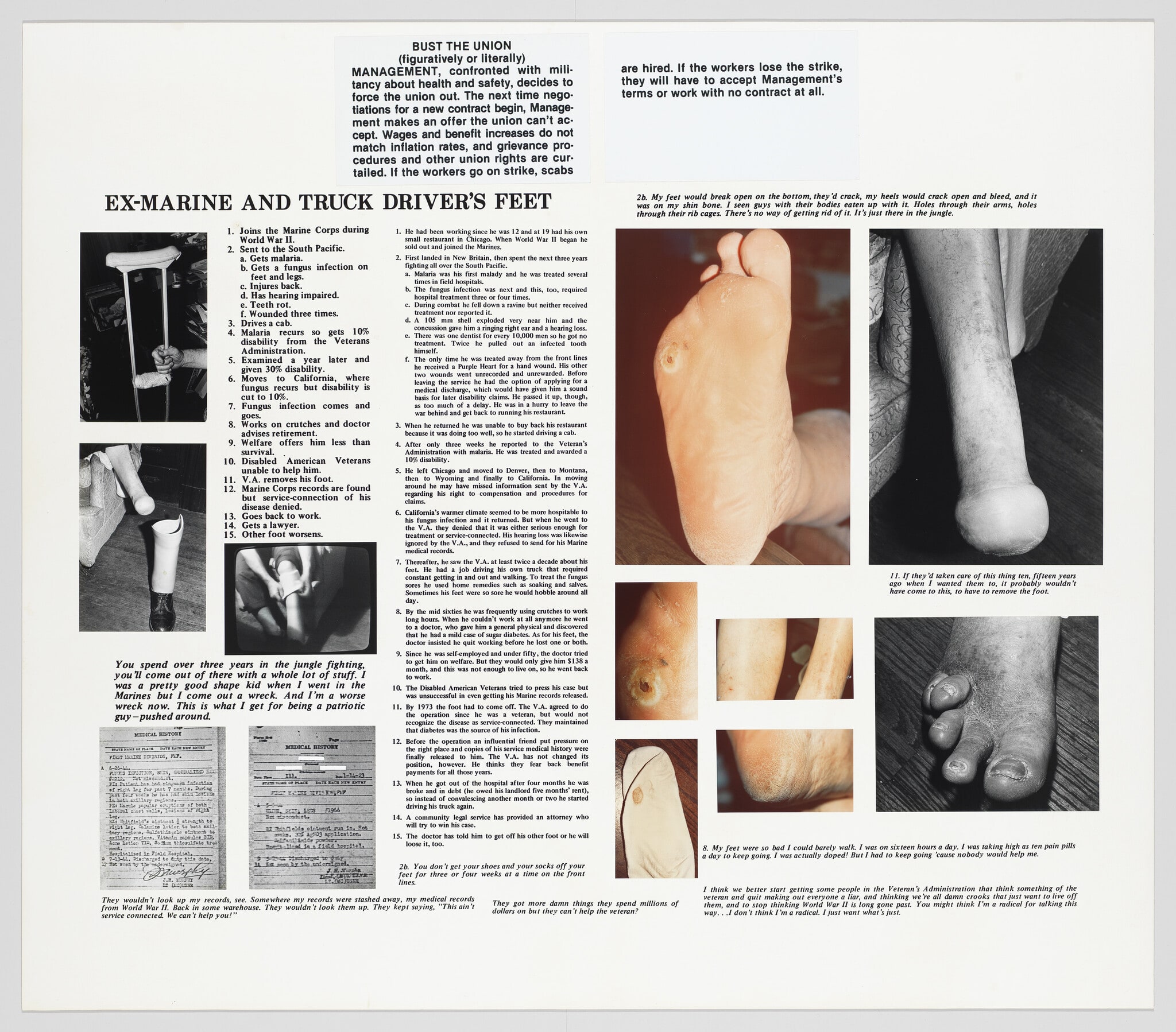 The Health and Safety Game: Ex-Marine and Truck Driver's Feet