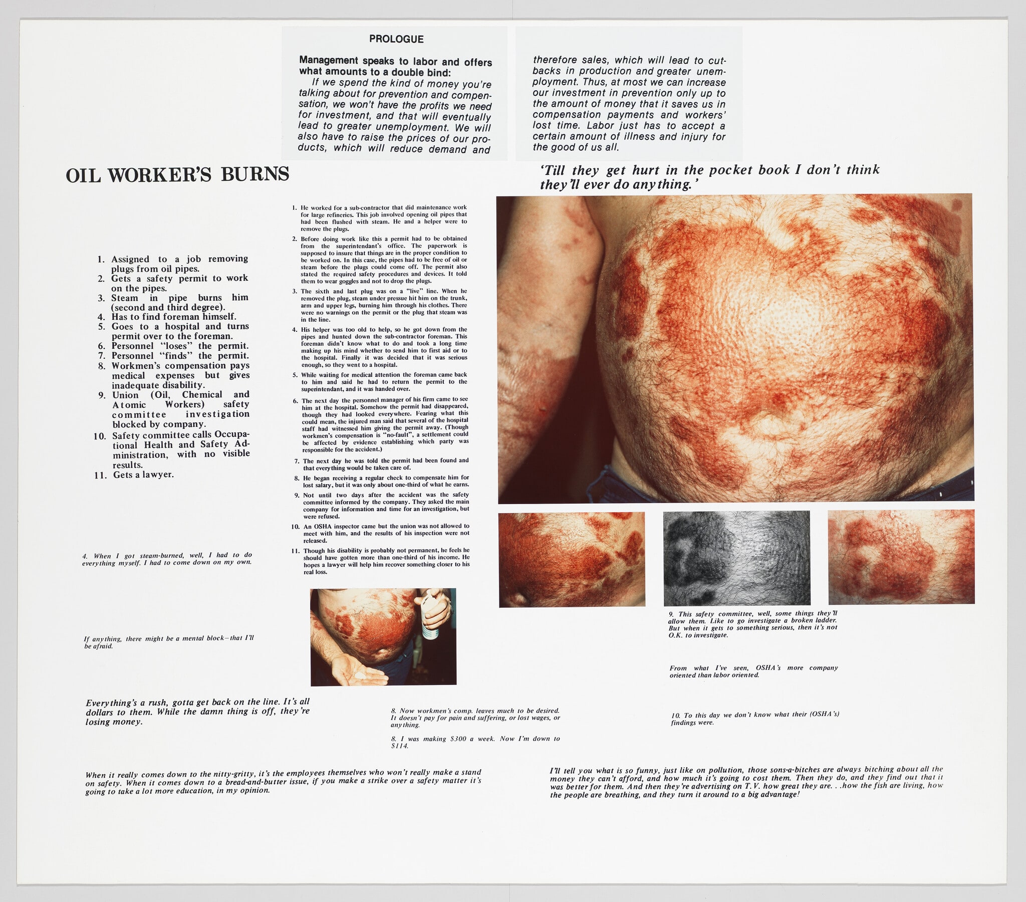 The Health and Safety Game: Oil Worker's Burns