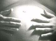 Antepartum
