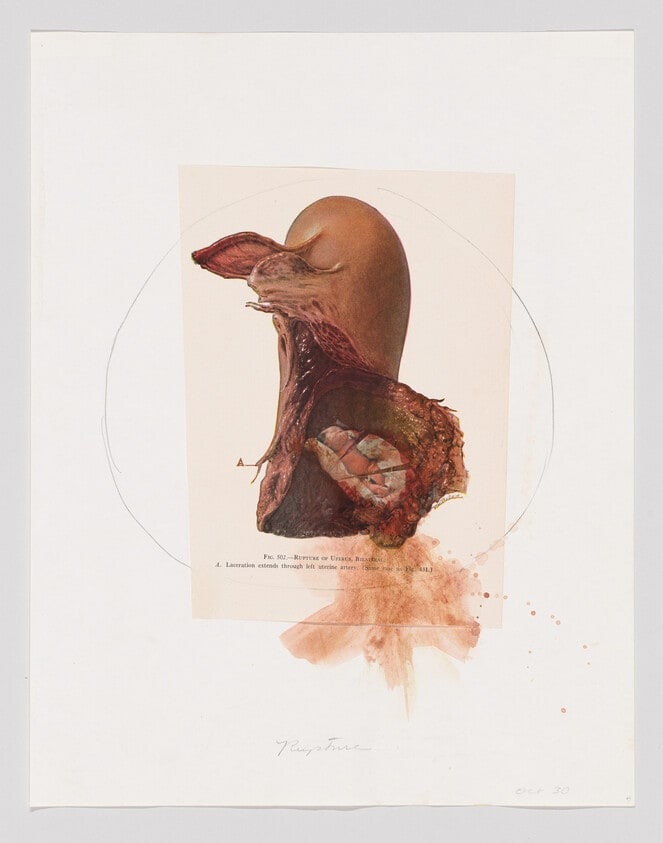 Rupture, October 30, 1973