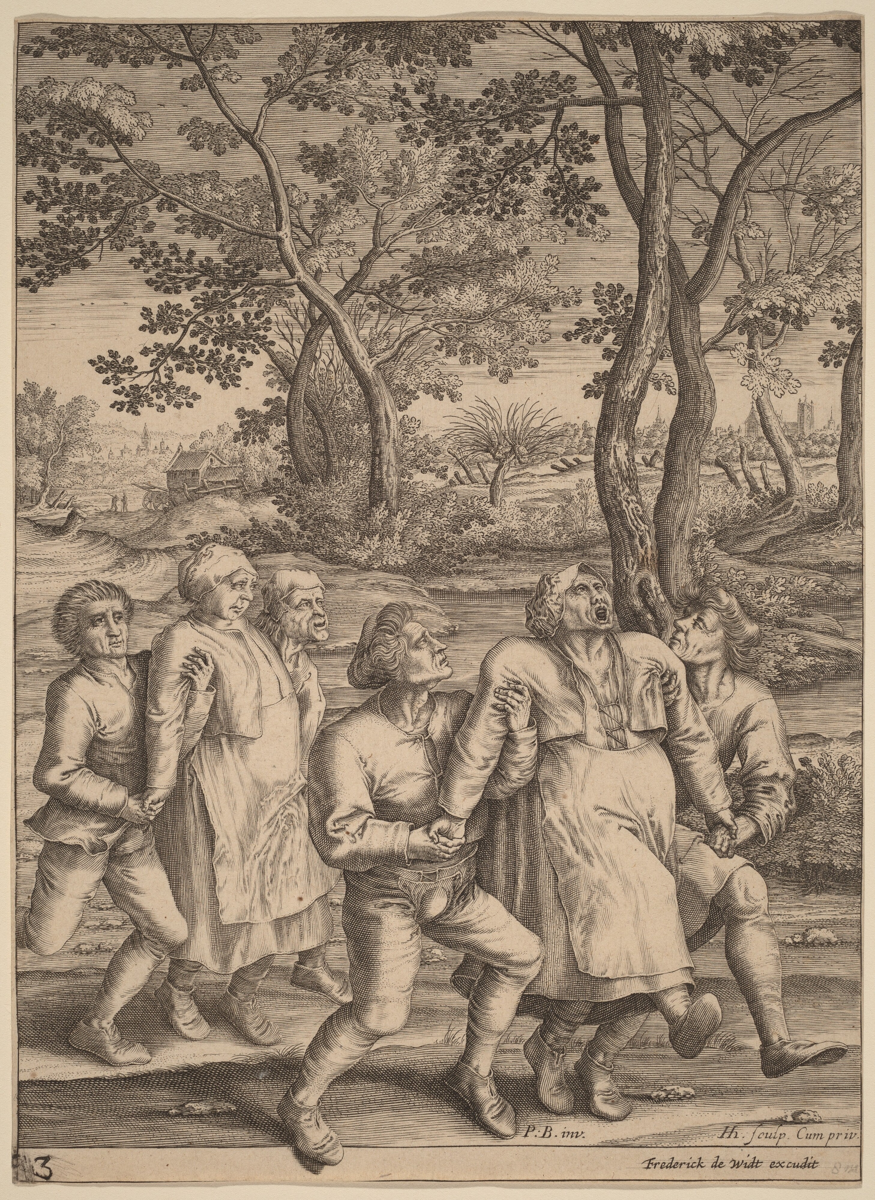 Epileptics Walking to the Right