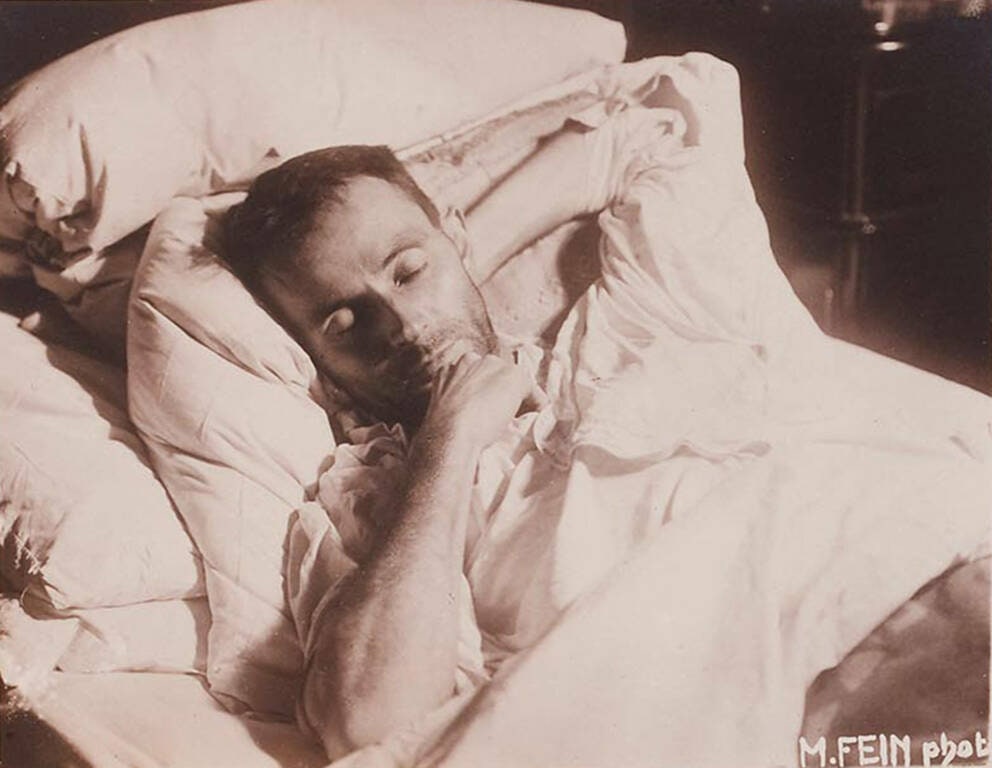 Egon Schiele on His Deathbed