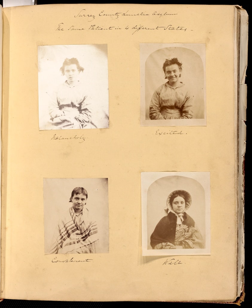 Surrey County Lunatic Asylum, The Same Patient in 4 Different States: Melancholy, Excited, Convalescent, Well Untitled, 1849–60, from the George Cowper Album, assembled 1849–60