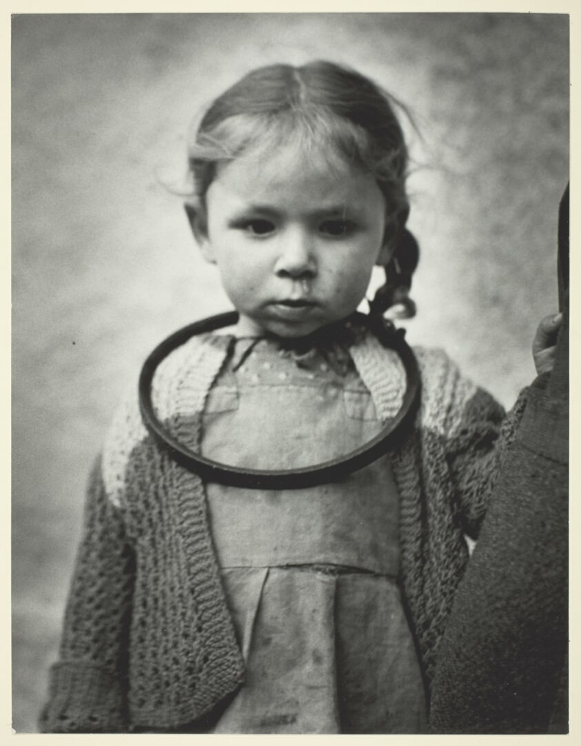 Little Girl with Ring Around Neck