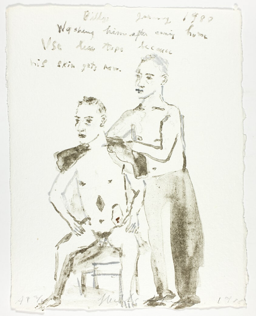 Billy, January 1988/Washing himself after coming home/use less tape because his skin gets hurt, from Bill's Surgery