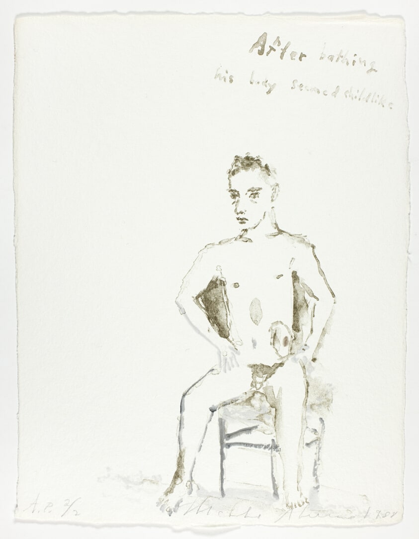 After Bathing His Body Seemed Childlike, from Bill's Surgery