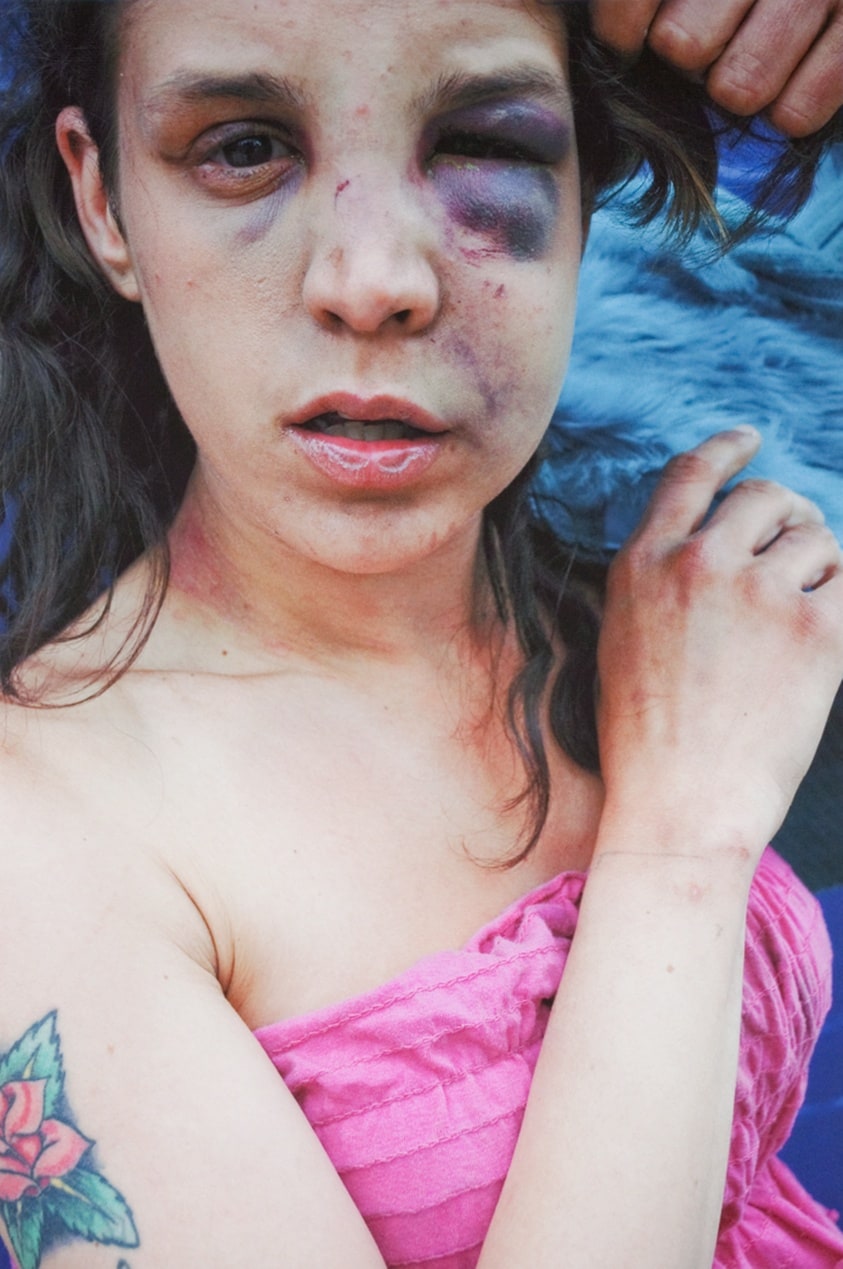 Monique Showing Black Eye