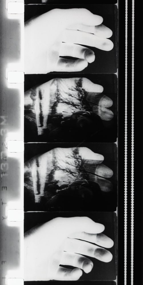 Traumatografo