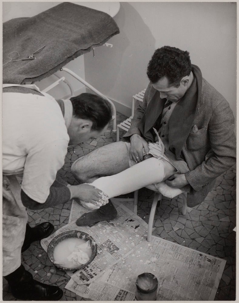 Prothésiste suisse moulant la jambe amputée d'un exilé espagnol, dans le sud de la France, en 1947-48