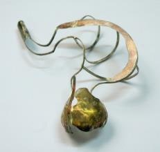 Gastro II